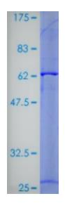 SDS-PAGE (DNASE1L3-1535H).jpg